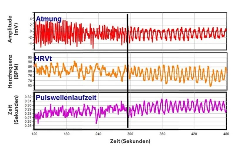 Diagramm einer Messung der Herzratenvariabilität mit drei Kurven.